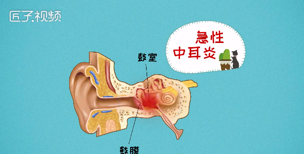耳甲腔疼痛图片