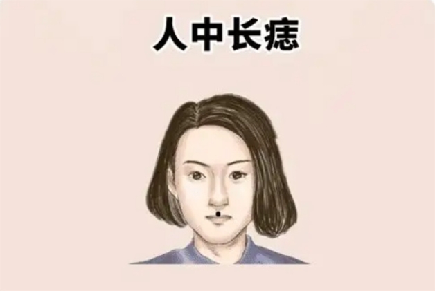 女人人中右侧有痣图解图片