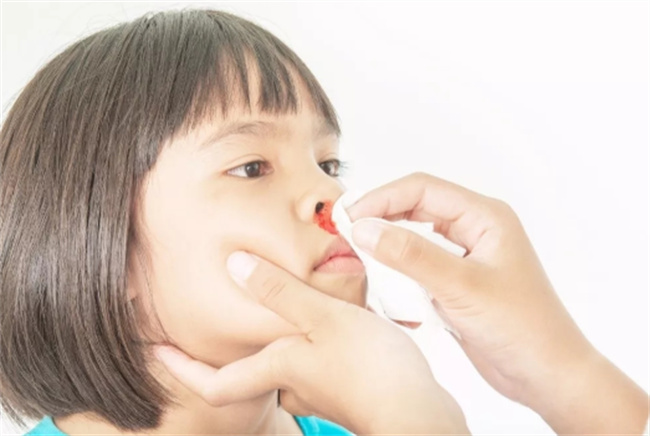 孩子流鼻血的正确处理方法