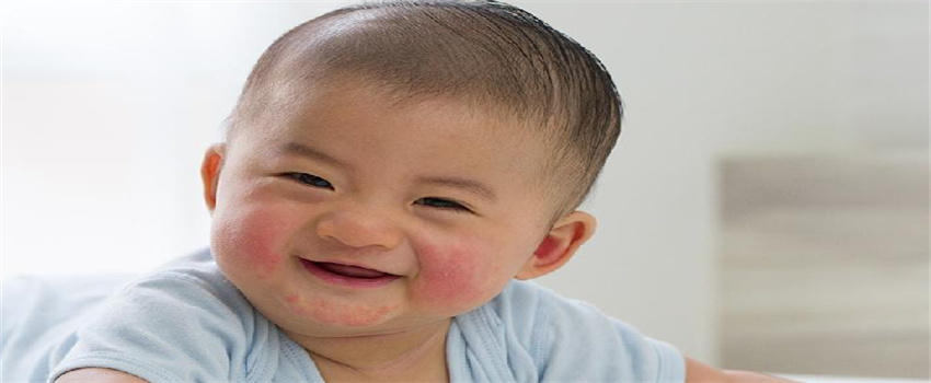 新生儿脸上有红斑是什么原因