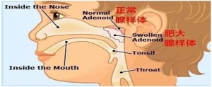 青春期孩子的脑垂体都肥大吗