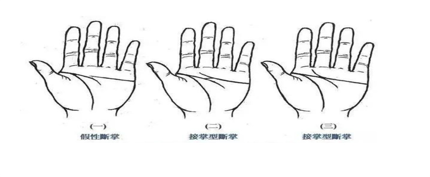 假断掌和真断掌手相的分辨方法（假断掌有智慧线和感情线，真断掌是智慧线和感情线连结）