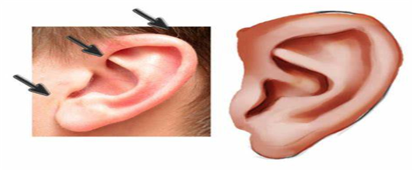 解析耳朵与人的性格和运势（不同的耳朵，不同的性格运势）