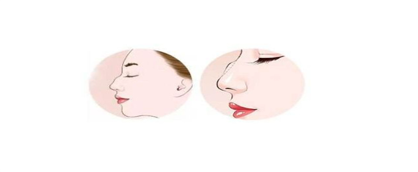不利于婚姻的鼻子有哪幾種（起節鼻，露脊鼻，朝天鼻）