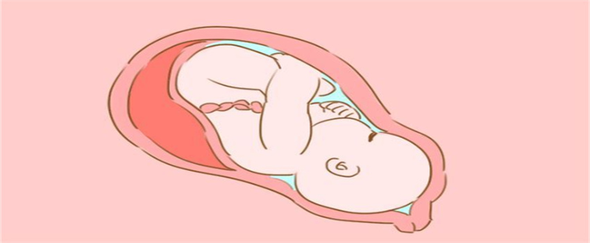 胎儿横位睡觉图片