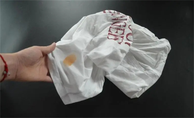 ​衣服上油渍去除小窍门 衣服上油渍去不掉了怎么办