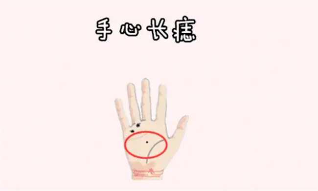 掌心痣代表了什么意思